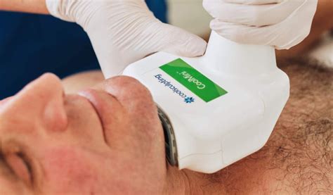 coolsculpting double chin reduction hill street clinic