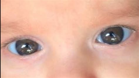 Hazel Eyed Babies? - Page 2 | BabyCenter