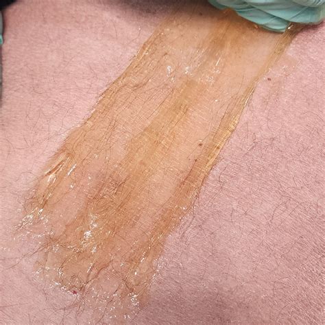 sugaring  sweetest   remove unwanted hair