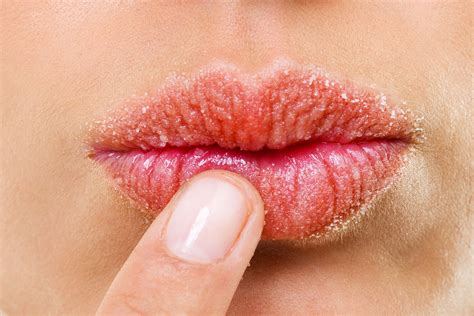 lips  dry  red depechemoderingtoneeos