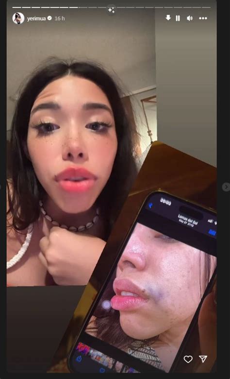 Yeri Mua muestra pruebas de agresiones que sufrió de Naim Darrechi