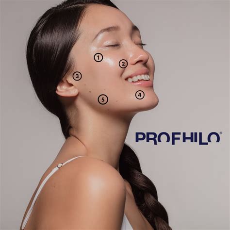 profhilo purpose risks results  procedure