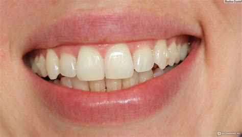 Зубной порошок Smilebe для чувствительных зубов - «И зубной порошок, и ...