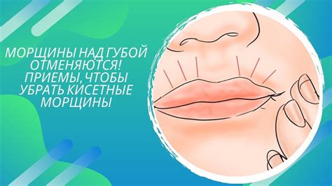 МОРЩИНЫ НАД ГУБОЙ отменяются! Как убрать кисетные морщины