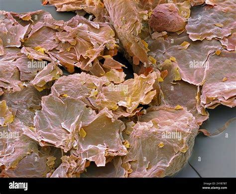 skin cells microscope  res stock photography  images alamy