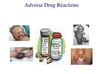 PPT - Adverse Drug Reactions PowerPoint Presentation, free download ...
