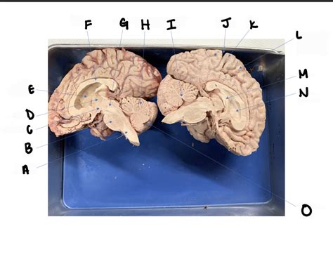 human brain dissection diagram quizlet