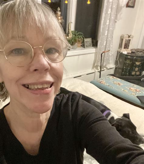 Before and After Full Hysterectomy/Cyst Removal : r/hysterectomy