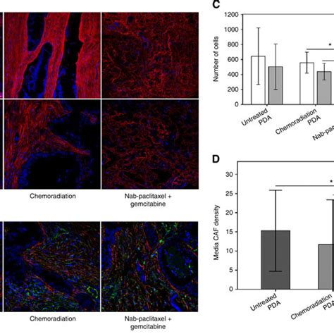 Antitumour effects of nab-paclitaxel and gemcitabine in PDA. Panels ...