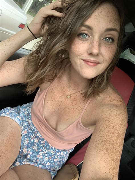 Freckle power 🏼 | Scrolller