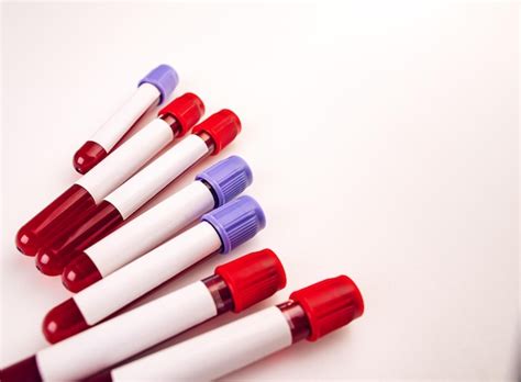 Premium Photo | Sample blood collection tubes