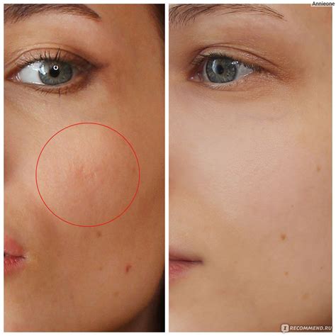 Сыворотка для лица L'Oreal Paris Revitalift с чистым ретинолом от ...