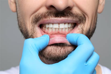 Can teeth rebuild themselves? A new gel could make it possible - Earth.com