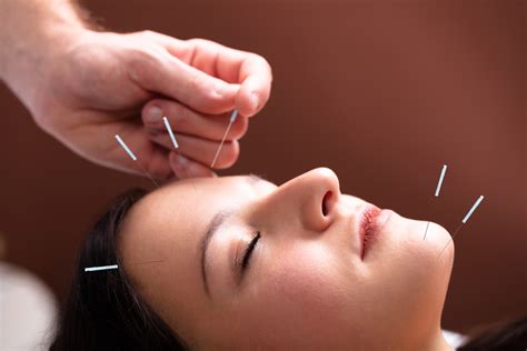 fun facts  acupuncture fact bud