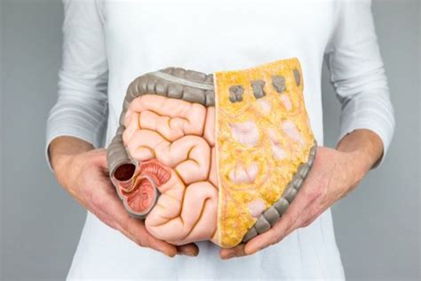 Дивертикулит: причины и симптомы воспаления | MedAboutMe