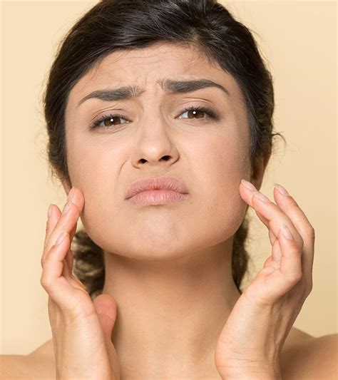 ashy skin     minimize