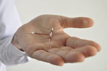 Implant Contraception