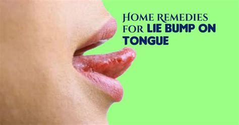 All the home remedies for lie bumps on tongue that have been discussed ...