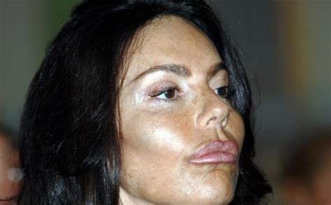 Rossella Barattolo sempre più rifatta: il lifting è un vizio in casa