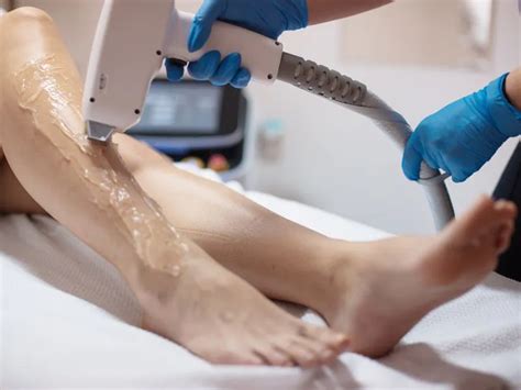 Fiz Depilação A Laser E Os Pelos Não Caíram