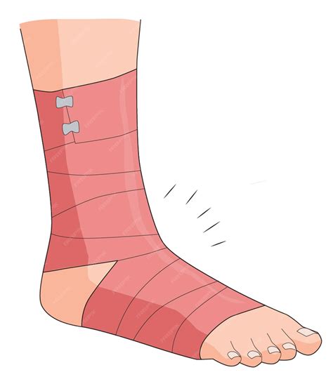 Premium Vector | Fractured leg wrapped with bandage
