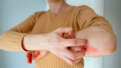 10 Signs When to Worry About a Rash