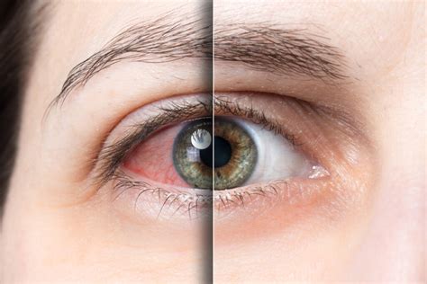 What Every Patient Should Know About MyIntegris Health - lcggh1j
