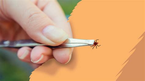 How to Remove a Tick from a Dog: 5 Easy Steps | BetterVet