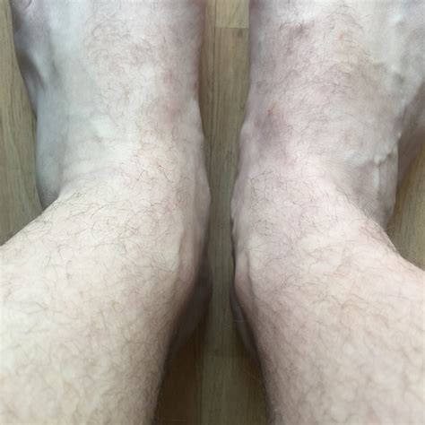 Reddit - Dive into anything