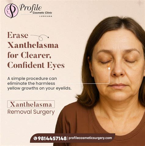 Profile Anesthetic Surgery | Say goodbye to stubborn yellow patches