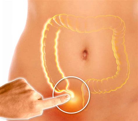Why The Appendix Is Much More Important Than We Once Thought