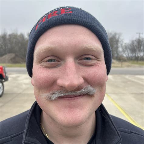 Dr. Eric Berg - It’s the lack of keto electrolytes that’s responsible