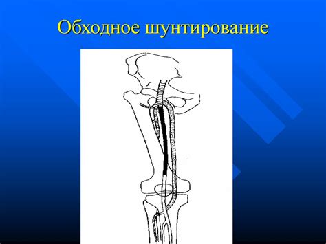 Операции на кровеносных сосудах - презентация онлайн