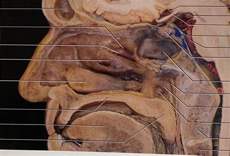 specimen divided   sagittal plane diagram quizlet