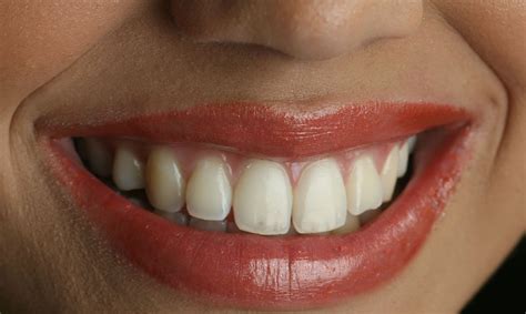 foods promote  development  optimal oral health kumneger media