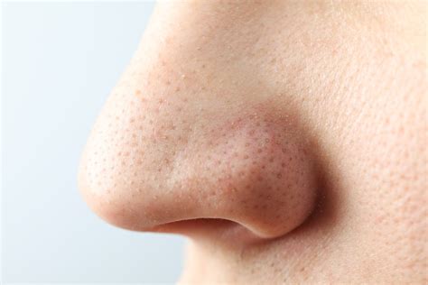 What Can Your Nose Do to Protect Against Illness? Plenty. - InsideHook