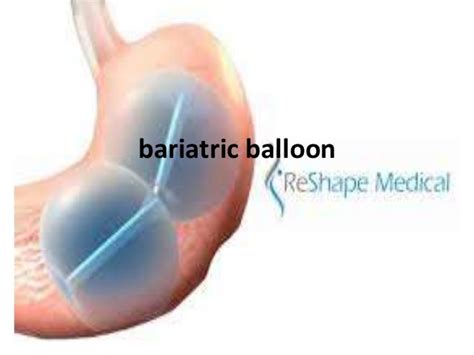 Bariatric balloon