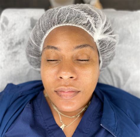 Dermaplaning facial | kreative kosmetiks
