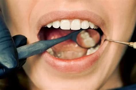 sakit gusi gejala kanker hati simak penjelasannya koran gala