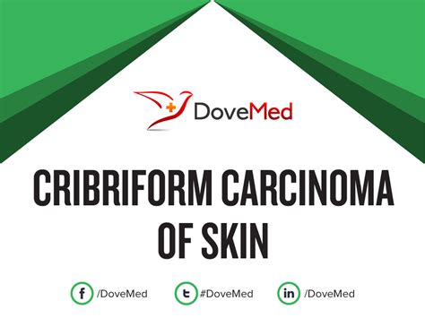 Cribriform Carcinoma of Skin