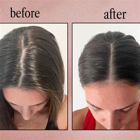 Using the best shampoo for dry scalps yields shocking results 19