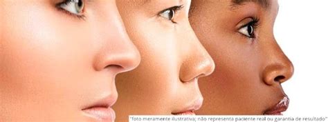 Nariz Fino E Arrebitado - Tipos de nariz: Conheça os tipos de nariz mais comuns