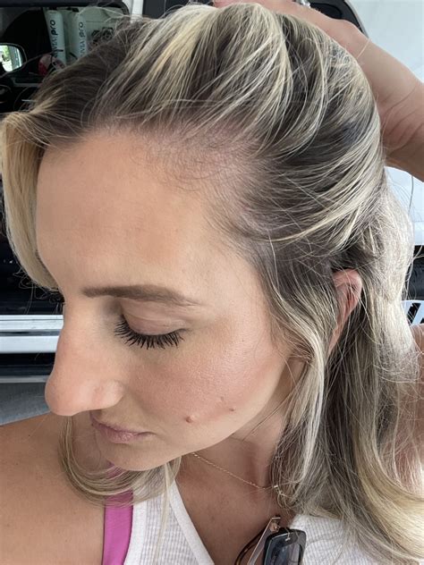 How to manage postpartum hair - emilyreneebarton.com