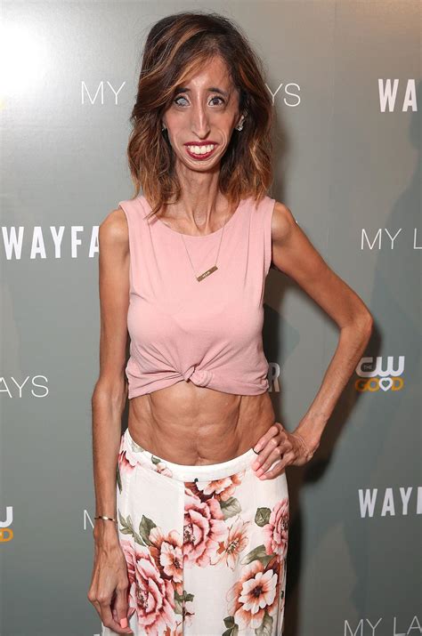 Lizzie Velasquez, Once Called the ‘World’s Ugliest Woman,’ Responds to