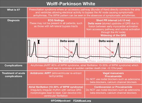 Supraventricular Tachycardia Treatment