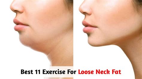 how to fix fat neck
