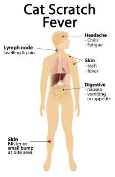 5 Cat Bite Infection Symptoms You Shouldn't Ignore | LoveToKnow