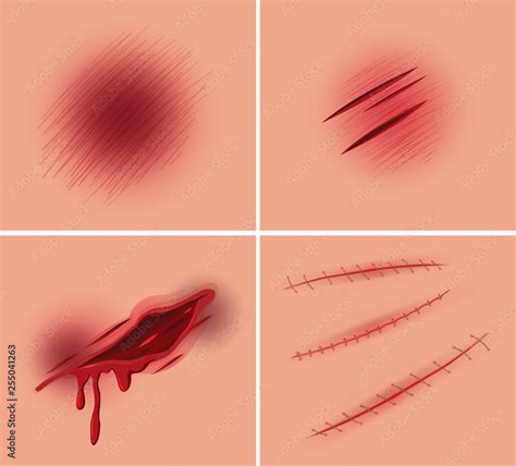 set  open wound stock vector adobe stock