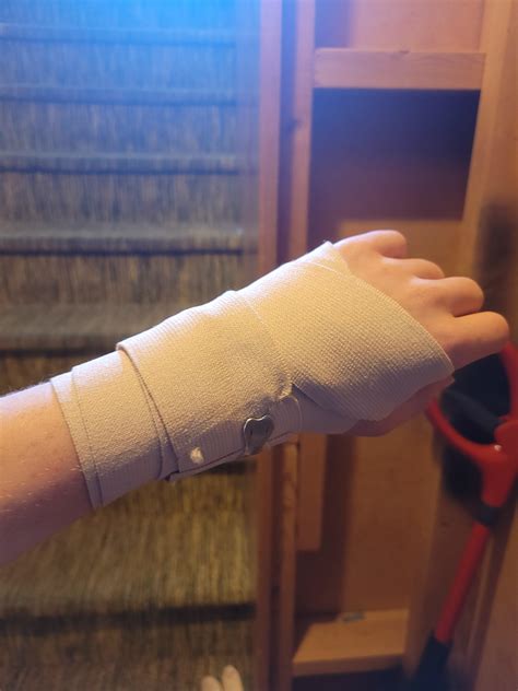 Almost broke my wrist at school today. : r/EliteEden