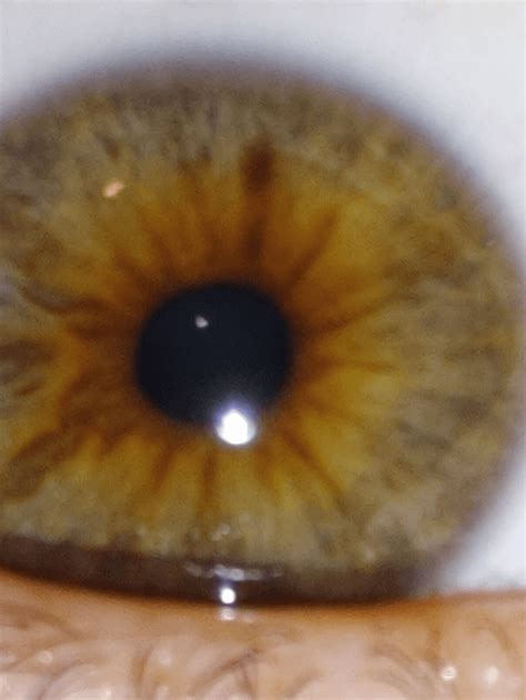 brown central heterochromia reyes